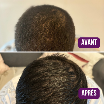 Lotion Pousse Extrême & Anti Chute de Cheveux - 100 ml - Sans Rinçage