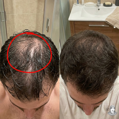 Lotion Pousse Extrême & Anti Chute de Cheveux - 100 ml - Sans Rinçage - Homme